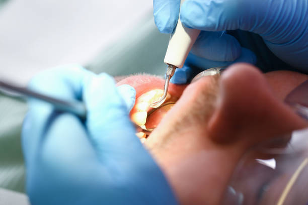 Best Urgent Tooth Repair  in Manitowoc, WI