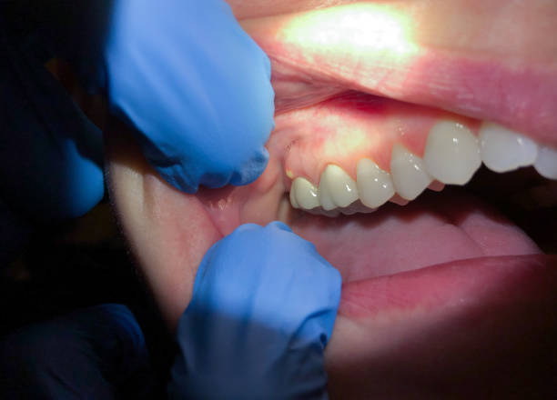 Best Urgent Tooth Repair  in Manitowoc, WI