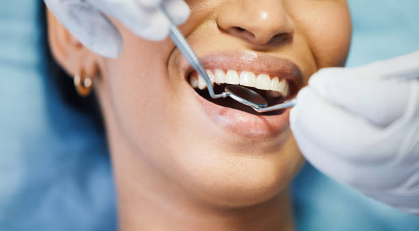 Best Chipped Tooth Repair Near Me  in Manitowoc, WI